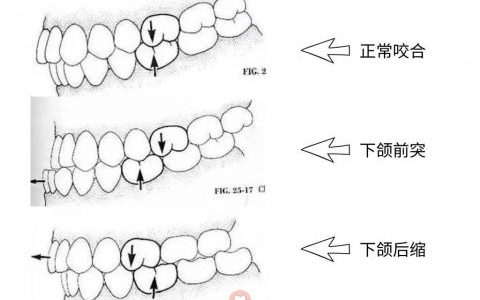正确的咬合关系图片