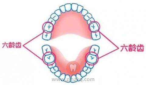 杭州修元口腔蛀牙六龄牙科普